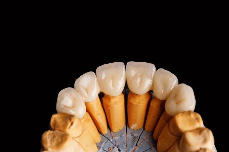 Zirconia Crowning